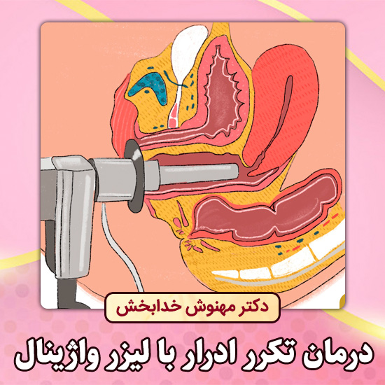 درمان-تکرر-ادرار-با-لیزر-واژینال