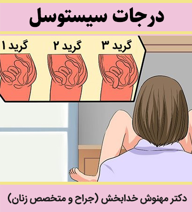 درجات-سیستوسل